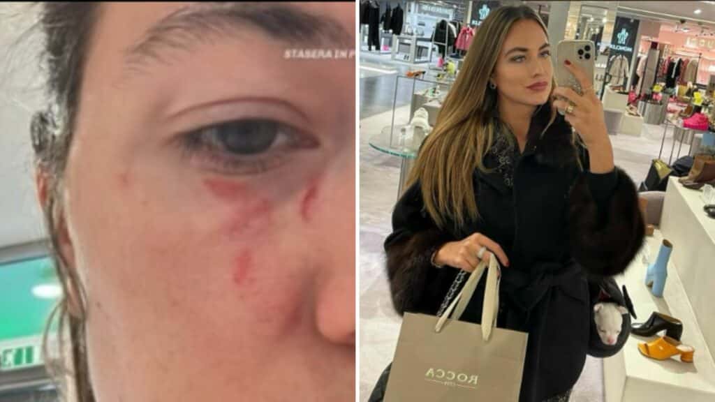 Omicidio Pamela, Soncin non risponde al gip: “Non era lucido”; contro di lei violenze ripetute, i segni sul volto nel selfie all’amica Omicidio Pamela, Soncin non risponde al gip: “Non era lucido”; contro di lei violenze ripetute, i segni sul volto nel selfie all’amica